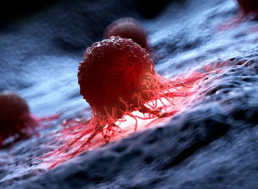 Интервью А.П. Серякова о ранней диагностике и лечении рака