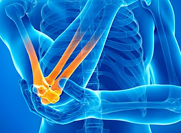 В «СМ-Клиника Северо-Запад» впервые выполнено эндопротезирование сустава